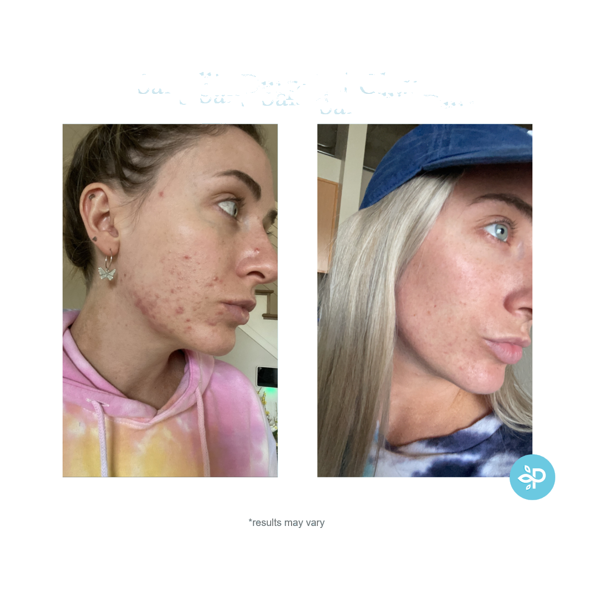 Salicylic Deep Gel Cleanser