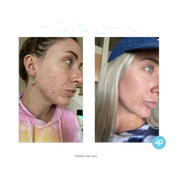 Salicylic Deep Gel Cleanser