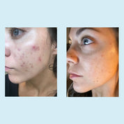 Salicylic Deep Gel Cleanser