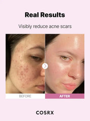 [COSRX] THE NIACINAMIDE 15 SERUM 20ML