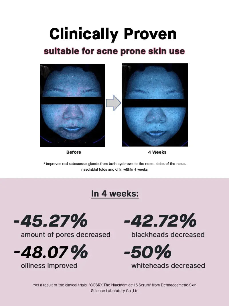 [COSRX] THE NIACINAMIDE 15 SERUM 20ML