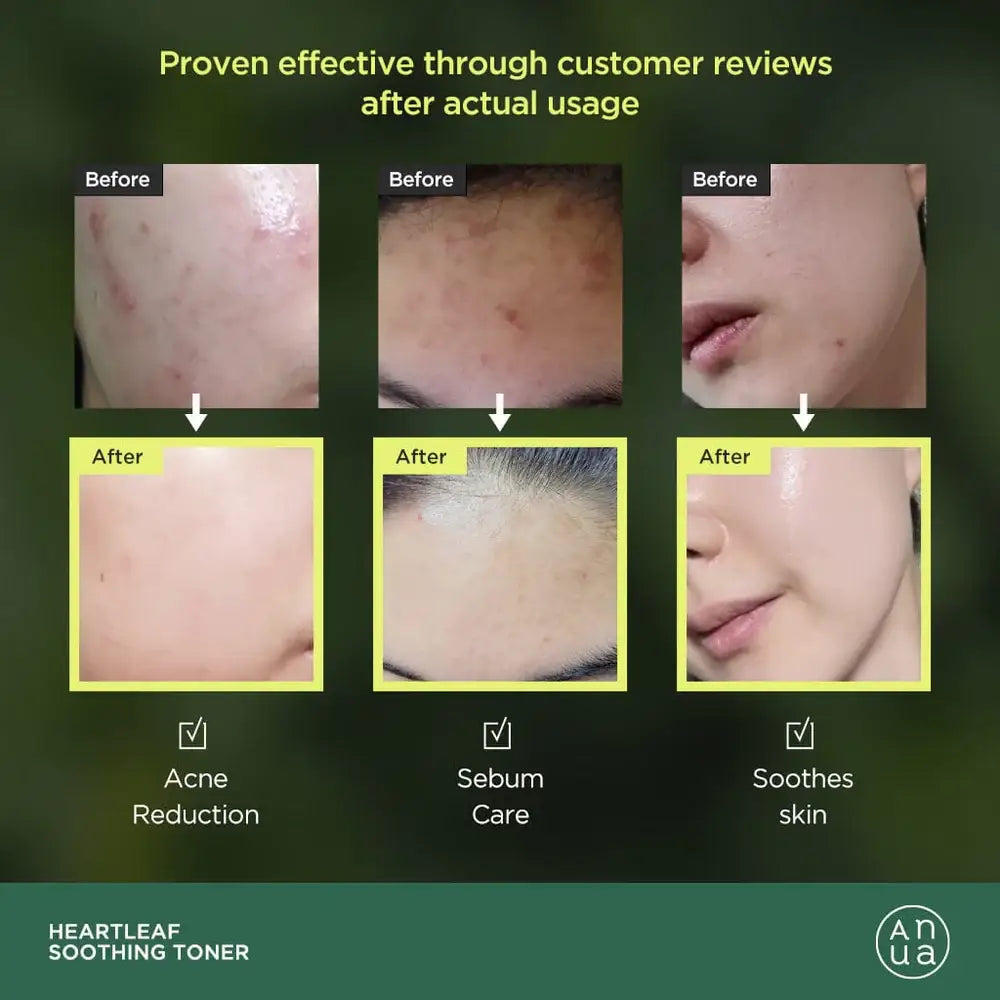 [ANUA] HEARTLEAF 77% SOOTHING TONER 250ML