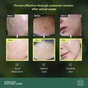 [ANUA] HEARTLEAF 77% SOOTHING TONER 250ML